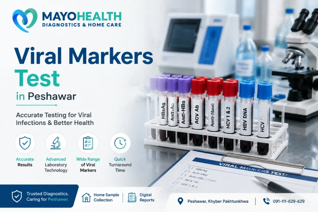 Viral Markers Test service at Mayo Health Diagnostic Lab & Home Care in Peshawar